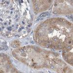 LRRC47 Antibody in Immunohistochemistry (IHC)