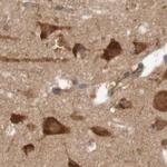 LRRC47 Antibody in Immunohistochemistry (IHC)