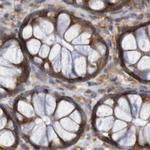 LRRC47 Antibody in Immunohistochemistry (IHC)