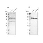 LRRC47 Antibody in Western Blot (WB)