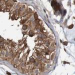 ARHGEF11 Antibody in Immunohistochemistry (IHC)