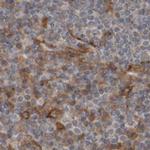 ARHGEF11 Antibody in Immunohistochemistry (IHC)