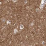 ARHGEF11 Antibody in Immunohistochemistry (IHC)