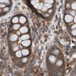 ARHGEF11 Antibody in Immunohistochemistry (IHC)