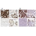 OXCT1 Antibody in Immunohistochemistry (IHC)