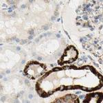 OXCT1 Antibody in Immunohistochemistry (IHC)