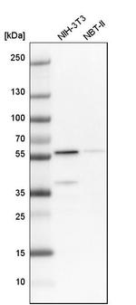 OXCT1 Antibody in Western Blot (WB)