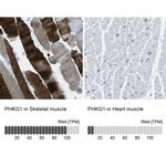 PHKG1 Antibody