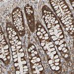 TMBIM1 Antibody in Immunohistochemistry (Paraffin) (IHC (P))