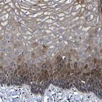 LEPRE1 Antibody in Immunohistochemistry (Paraffin) (IHC (P))