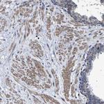 LEPRE1 Antibody in Immunohistochemistry (Paraffin) (IHC (P))