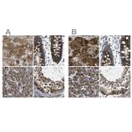 ACBD5 Antibody in Immunohistochemistry (IHC)