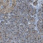 ACBD5 Antibody in Immunohistochemistry (IHC)