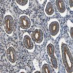 INPP5A Antibody in Immunohistochemistry (Paraffin) (IHC (P))