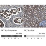 INPP5A Antibody in Immunohistochemistry (IHC)