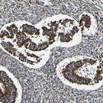 INPP5A Antibody in Immunohistochemistry (IHC)