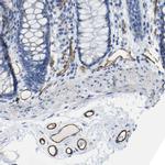 CD93 Antibody in Immunohistochemistry (IHC)