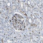 CD93 Antibody in Immunohistochemistry (IHC)