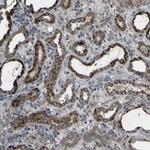 GPLD1 Antibody in Immunohistochemistry (Paraffin) (IHC (P))