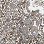 DDAH2 Antibody in Immunohistochemistry (Paraffin) (IHC (P))