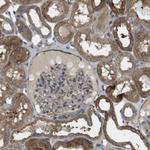 DDAH2 Antibody in Immunohistochemistry (Paraffin) (IHC (P))