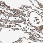 DDAH2 Antibody in Immunohistochemistry (Paraffin) (IHC (P))