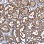 FBP1/FBP2 Antibody in Immunohistochemistry (IHC)