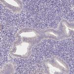 AZGP1 Antibody in Immunohistochemistry (IHC)