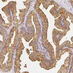 AZGP1 Antibody in Immunohistochemistry (IHC)