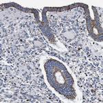 FKBP9 Antibody in Immunohistochemistry (Paraffin) (IHC (P))