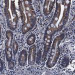 FKBP9 Antibody in Immunohistochemistry (Paraffin) (IHC (P))