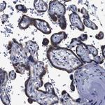 FKBP9 Antibody in Immunohistochemistry (Paraffin) (IHC (P))