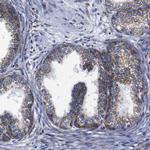 FKBP9 Antibody in Immunohistochemistry (Paraffin) (IHC (P))