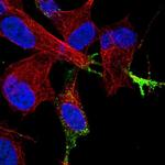 Chromogranin B Antibody in Immunocytochemistry (ICC/IF)