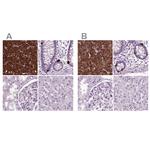 Chromogranin B Antibody in Immunohistochemistry (IHC)