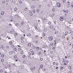 Chromogranin B Antibody in Immunohistochemistry (IHC)