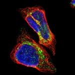 ALDH18A1 Antibody in Immunocytochemistry (ICC/IF)