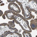 ALDH18A1 Antibody in Immunohistochemistry (IHC)