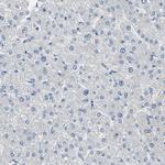 ALDH18A1 Antibody in Immunohistochemistry (IHC)