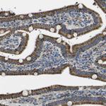 ALDH18A1 Antibody in Immunohistochemistry (IHC)