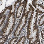 ALDH18A1 Antibody in Immunohistochemistry (IHC)