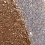 NRCAM Antibody in Immunohistochemistry (IHC)