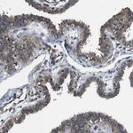 UBXN1 Antibody in Immunohistochemistry (Paraffin) (IHC (P))