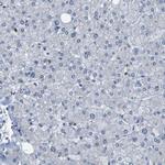 UBXN1 Antibody in Immunohistochemistry (Paraffin) (IHC (P))