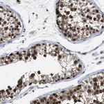 UBXN1 Antibody in Immunohistochemistry (Paraffin) (IHC (P))