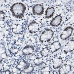 DACH1 Antibody in Immunohistochemistry (Paraffin) (IHC (P))