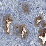 CSP alpha Antibody in Immunohistochemistry (Paraffin) (IHC (P))