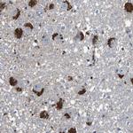 CYP2W1 Antibody in Immunohistochemistry (Paraffin) (IHC (P))