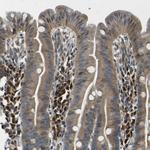 EML2 Antibody in Immunohistochemistry (Paraffin) (IHC (P))