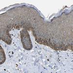 EML2 Antibody in Immunohistochemistry (Paraffin) (IHC (P))